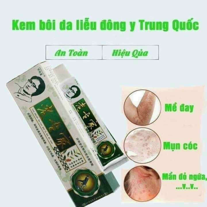 kem bôi da liễu đông y Trung Quốc - ông lão - tuýp 10gr 